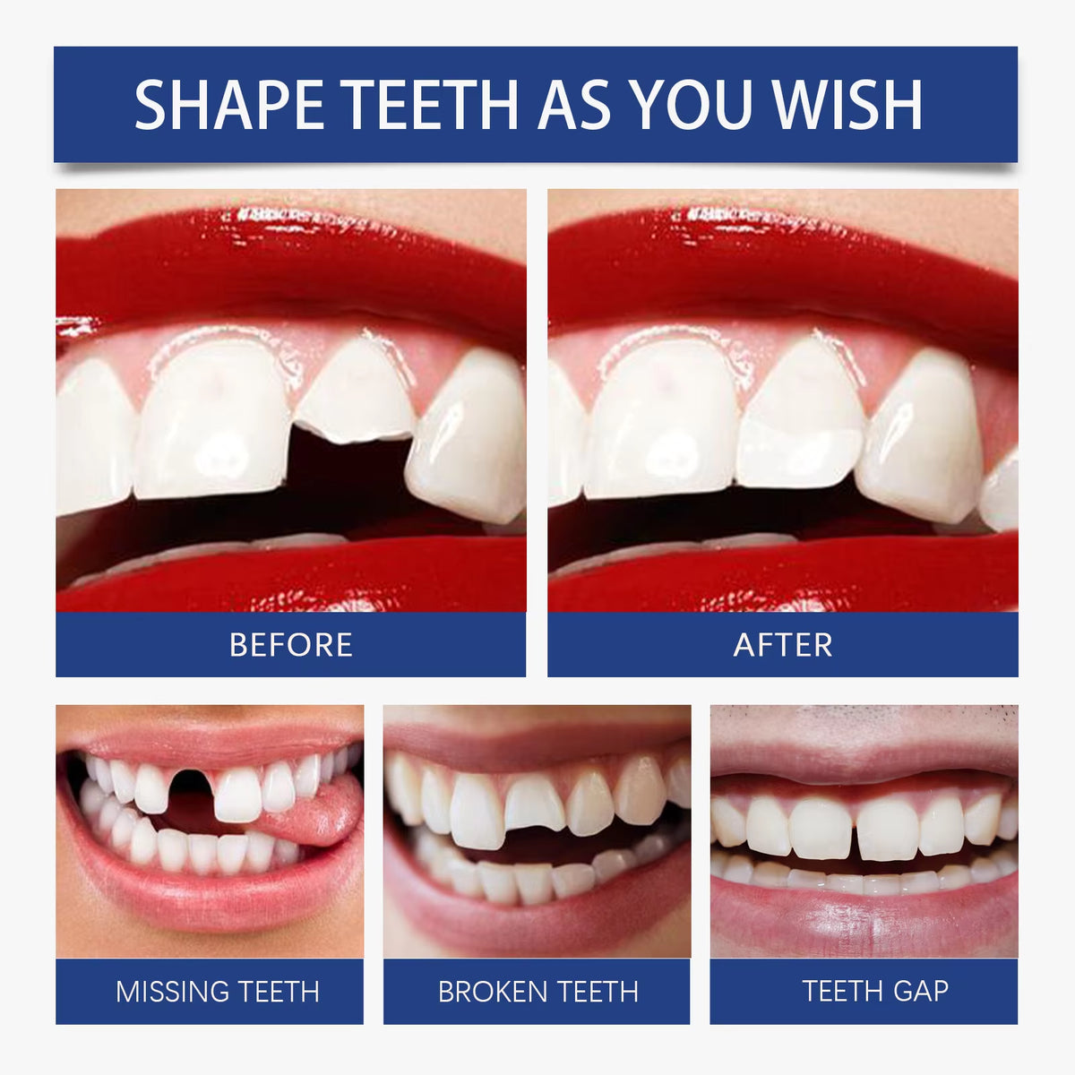 Pegamento Reparador Temporal De Dientes