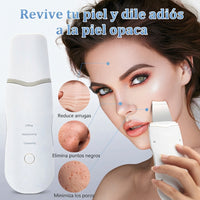 Depiladora De Puntos Negros Ultrasónica - Espátula Facial De Limpieza Profunda