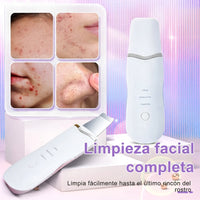 Depiladora De Puntos Negros Ultrasónica - Espátula Facial De Limpieza Profunda